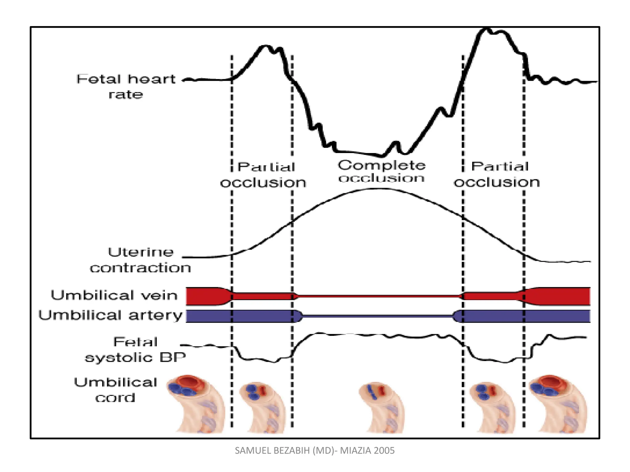 SAMUEL BEZABIH (MD)- MIAZIA 2005
 