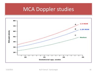 MCA Doppler studies
7/10/2016 By Dr Samuel --Gynecologist 18
 