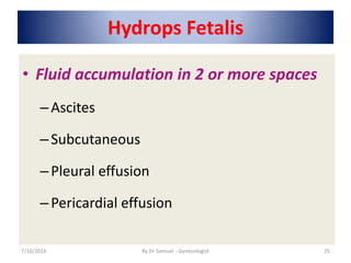 Hydrops Fetalis
• Fluid accumulation in 2 or more spaces
–Ascites
–Subcutaneous
–Pleural effusion
–Pericardial effusion
7/10/2016 By Dr Samuel --Gynecologist 25
 