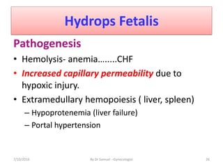 Hydrops Fetalis
Pathogenesis
• Hemolysis- anemia….....CHF
• Increased capillary permeability due to
hypoxic injury.
• Extramedullary hemopoiesis ( liver, spleen)
– Hypoprotenemia (liver failure)
– Portal hypertension
7/10/2016 By Dr Samuel --Gynecologist 26
 