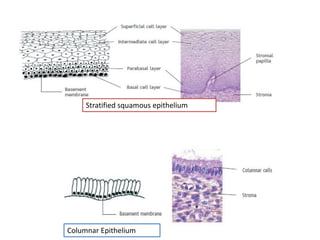 Columnar Epithelium
Stratified squamous epithelium
 