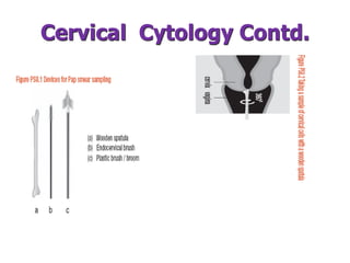 Cervical Cytology Contd.
 