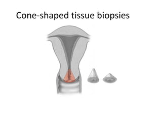 Cone-shaped tissue biopsies
 