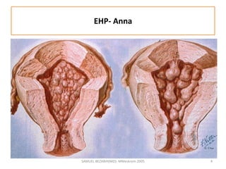 EHP- Anna
SAMUEL BEZABIH(MD)- MMeskrem 2005 4
 