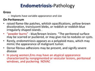 Endometriosis-Pathology
Gross
– Implants have variable appearance and size
On Peritoneum
• raised flame-like patches, whitish opacifications, yellow-brown
discoloration, translucent blebs, or reddish or reddish-blue
irregularly shaped islands .
• “powder burns” - blue/brown lesions “The peritoneal surface
may be scarred or puckered, or may give rise to nodules or cysts.
• Rarely, endometriosis appears as a polyploid mass, which may
mimic the appearance of malignant tumor.
• Dense fibrous adhesions may be present, and signify severe
disease
• In young women,Ems may have an atypical appearance
characterized by nonpigmented or vesicular lesions, peritoneal
windows, and puckering NOVAC
 