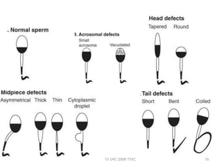 ሳሙኤል በዛብህ ህዳር 2006 ጎንደር 70
 