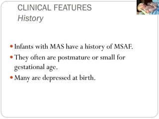 CLINICAL FEATURES
History
Infants with MAS have a history of MSAF.
They often are postmature or small for
gestational age.
Many are depressed at birth.
 