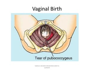 Vaginal Birth
SAMUEL BEZABIH MESKEREM 2004 EC
GONDER
 