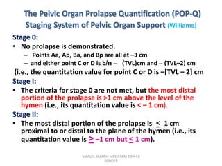 The Pelvic Organ Prolapse Quantification (POP-Q)
Staging System of Pelvic Organ Support (Williams)
Stage 0:
• No prolapse is demonstrated.
– Points Aa, Ap, Ba, and Bp are all at –3 cm
– and either point C or D is b/n – (TVL)cm and – (TVL–2) cm
(i.e., the quantitation value for point C or D is –[TVL – 2] cm
Stage I:
• The criteria for stage 0 are not met, but the most distal
portion of the prolapse is >1 cm above the level of the
hymen (i.e., its quantitation value is < – 1 cm).
Stage II:
• The most distal portion of the prolapse is < 1 cm
proximal to or distal to the plane of the hymen (i.e., its
quantitation value is > –1 cm but < 1 cm).
SAMUEL BEZABIH MESKEREM 2004 EC
GONDER
 