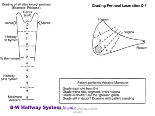 SAMUEL BEZABIH MESKEREM 2004 EC
GONDER
B-W Halfway System Telinde
 