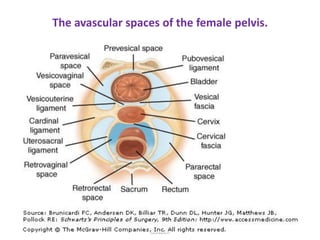 The avascular spaces of the female pelvis.
SAMUEL BEZABIH MESKEREM 2004 EC
GONDER
 