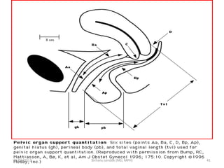 05/04/2012 41
Birhanu sendek (MD, MPH)
 