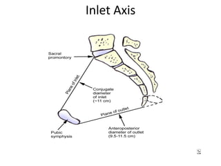Inlet Axis
 