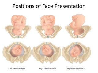 Positions of Face Presentation
 