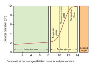 Composite of the average dilatation curve for nulliparous labor.
 