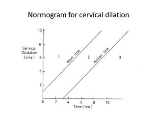 Normogram for cervical dilation
 