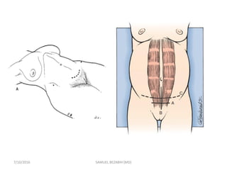 7/10/2016 SAMUEL BEZABIH (MD)
 