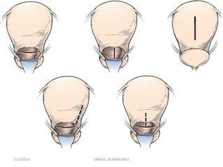 7/10/2016 SAMUEL BEZABIH (MD)
 
