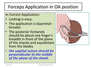 7/10/2016 SAMUEL BEZABIH (MD)
Forceps Application in OA position
In Correct Application:
• Locking is easy;
• The application is biparietal -
bimalar.
• The posterior fontanels
should be about one finger’s
breadth in front of the plane
of the shanks and equidistant
from the blades
• the sagittal suture should be
perpendicular to the middle
of the plane of the shank.
 