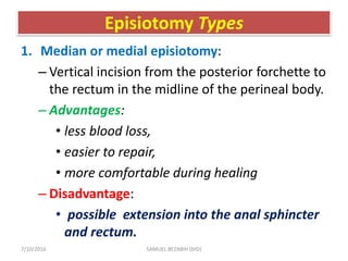 Episiotomy Types
1. Median or medial episiotomy:
– Vertical incision from the posterior forchette to
the rectum in the midline of the perineal body.
– Advantages:
• less blood loss,
• easier to repair,
• more comfortable during healing
– Disadvantage:
• possible extension into the anal sphincter
and rectum.
7/10/2016 SAMUEL BEZABIH (MD)
 