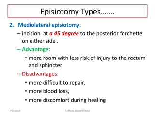 Episiotomy Types…….
2. Mediolateral episiotomy:
– incision at a 45 degree to the posterior forchette
on either side .
– Advantage:
• more room with less risk of injury to the rectum
and sphincter
– Disadvantages:
• more difficult to repair,
• more blood loss,
• more discomfort during healing
7/10/2016 SAMUEL BEZABIH (MD)
 
