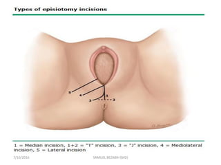 7/10/2016 SAMUEL BEZABIH (MD)
 