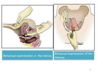 Bimanual examination of the Uterus
Bimanual examination of the
Adnexa
55
 