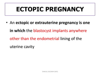 ECTOPIC PREGNANCY
• An ectopic or extrauterine pregnancy is one
in which the blastocyst implants anywhere
other than the endometrial lining of the
uterine cavity
SAMUEL BEZABIH (MD)
 