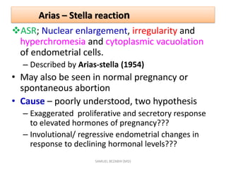 Arias – Stella reaction
ASR; Nuclear enlargement, irregularity and
hyperchromesia and cytoplasmic vacuolation
of endometrial cells.
– Described by Arias-stella (1954)
• May also be seen in normal pregnancy or
spontaneous abortion
• Cause – poorly understood, two hypothesis
– Exaggerated proliferative and secretory response
to elevated hormones of pregnancy???
– Involutional/ regressive endometrial changes in
response to declining hormonal levels???
SAMUEL BEZABIH (MD)
 