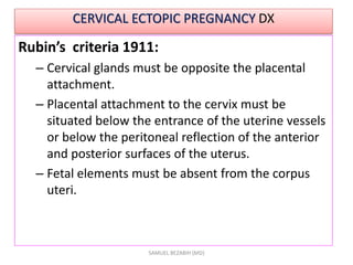 CERVICAL ECTOPIC PREGNANCY DX
Rubin’s criteria 1911:
– Cervical glands must be opposite the placental
attachment.
– Placental attachment to the cervix must be
situated below the entrance of the uterine vessels
or below the peritoneal reflection of the anterior
and posterior surfaces of the uterus.
– Fetal elements must be absent from the corpus
uteri.
SAMUEL BEZABIH (MD)
 