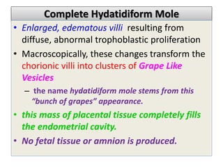 Complete Hydatidiform Mole
• Enlarged, edematous villi resulting from
diffuse, abnormal trophoblastic proliferation
• Macroscopically, these changes transform the
chorionic villi into clusters of Grape Like
Vesicles
– the name hydatidiform mole stems from this
“bunch of grapes” appearance.
• this mass of placental tissue completely fills
the endometrial cavity.
• No fetal tissue or amnion is produced.
 