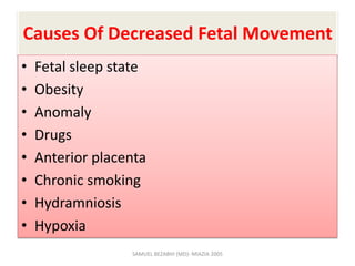 Causes Of Decreased Fetal Movement
• Fetal sleep state
• Obesity
• Anomaly
• Drugs
• Anterior placenta
• Chronic smoking
• Hydramniosis
• Hypoxia
SAMUEL BEZABIH (MD)- MIAZIA 2005
 