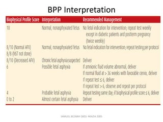 BPP Interpretation
SAMUEL BEZABIH (MD)- MIAZIA 2005
 