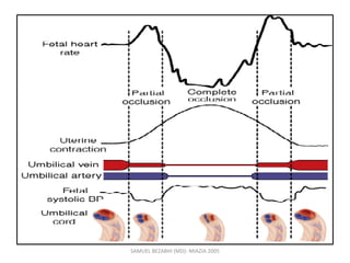 SAMUEL BEZABIH (MD)- MIAZIA 2005
 