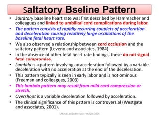 Saltatory Bseline Pattern
• Saltatory baseline heart rate was first described by Hammacher and
colleagues and linked to umbilical cord complications during labor.
• The pattern consists of rapidly recurring couplets of acceleration
and deceleration causing relatively large oscillations of the
baseline fetal heart rate.
• We also observed a relationship between cord occlusion and the
saltatory pattern (Leveno and associates, 1984).
• In the absence of other fetal heart rate findings, these do not signal
fetal compromise.
• Lambda is a pattern involving an acceleration followed by a variable
deceleration with no acceleration at the end of the deceleration.
• This pattern typically is seen in early labor and is not ominous
(Freeman and colleagues, 2003).
• This lambda pattern may result from mild cord compression or
stretch.
• Overshoot is a variable deceleration followed by acceleration.
• The clinical significance of this pattern is controversial (Westgate
and associates, 2001).
SAMUEL BEZABIH (MD)- MIAZIA 2005
 