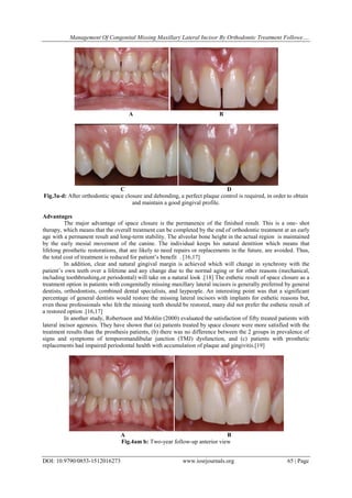 Combined orthodontic and prosthetic therapy special considerations.(52 ...