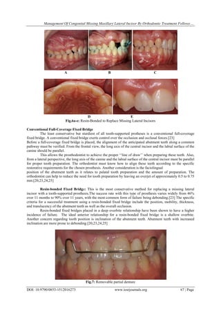Combined orthodontic and prosthetic therapy special considerations.(52 ...