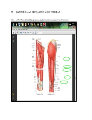 3.5 GAMBAR RAJAH OTOT AGONIS YANG TERLIBAT
Otot : Otot Hamstring ( Biseps Femoris, Semitendinosus, Semimembranosus)
 