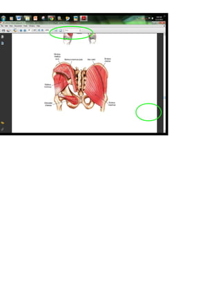 Otot : Gluteus Maksimus
 
