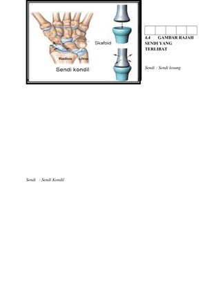 4.4 GAMBAR RAJAH
SENDI YANG
TERLIBAT
Sendi : Sendi lesung
Sendi : Sendi Kondil
 