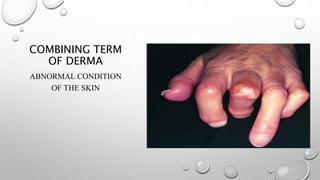 COMBINING TERM
OF DERMA
ABNORMAL CONDITION
OF THE SKIN
 