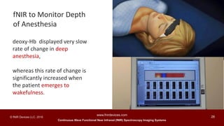 Continuous Wave Functional Near Infrared (fNIR) Spectroscopy Imaging Systems
www.fnirdevices.com
26© fNIR Devices LLC. 2016
deoxy-Hb displayed very slow
rate of change in deep
anesthesia,
whereas this rate of change is
significantly increased when
the patient emerges to
wakefulness.
fNIR to Monitor Depth
of Anesthesia
 