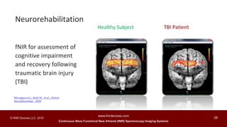 Continuous Wave Functional Near Infrared (fNIR) Spectroscopy Imaging Systems
www.fnirdevices.com
28© fNIR Devices LLC. 2016
fNIR for assessment of
cognitive impairment
and recovery following
traumatic brain injury
(TBI)
Healthy Subject TBI Patient
Neurorehabilitation
Merzagora A.C., Butti M. et al., Clinical
Neurophysiology , 2009
 