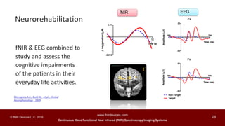 Continuous Wave Functional Near Infrared (fNIR) Spectroscopy Imaging Systems
www.fnirdevices.com
29© fNIR Devices LLC. 2016
Cz
-300 700
-20
20
Time (ms)
Amplitude(V)
Pz
Non-Target
Target
-300 700
-20
20
Time (ms)
Amplitude(V)
-0.015
0.01
12
Time (s)
oxygenation(M)
fNIR EEG
fNIR & EEG combined to
study and assess the
cognitive impairments
of the patients in their
everyday life activities.
Neurorehabilitation
Merzagora A.C., Butti M. et al., Clinical
Neurophysiology , 2009
 