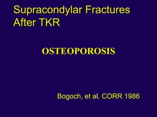 Supracondylar Fractures
After TKR
OSTEOPOROSIS
Bogoch, et al, CORR 1986
 