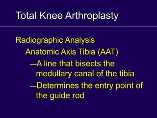 Total Knee Arthroplasty
Radiographic Analysis
Anatomic Axis Tibia (AAT)
—A line that bisects the
medullary canal of the tibia
—Determines the entry point of
the guide rod
 