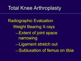 Total Knee Arthroplasty
Radiographic Evaluation
Weight Bearing X-rays
—Extent of joint space
narrowing
—Ligament stretch out
—Subluxation of femus on tibia
 