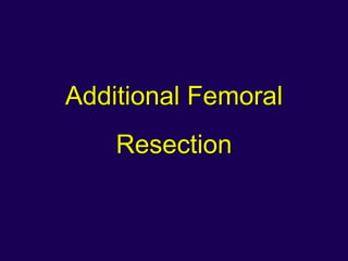 Additional Femoral
Resection
 