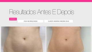 FOCO EM RESULTADOS CLIENT E ONODE RA RIBE IR ÃO FE LIZ
ONO DERA
Resultados Antes E Depois
 
