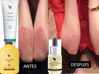 VíctorHugo Ramírez
DistribuidorIndependiente.
Móvil: 3214367474 Colombia.
Email : naturalmenteforever@hotmail.com
Skype: victorh_ramirez
twitter: @vhramirezflp
SISTEMA INMUNE
 